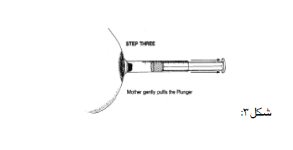 سرنگ در شیردهی