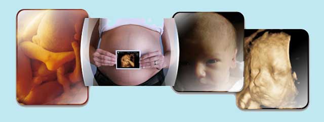 سونوگرافی آنومالی