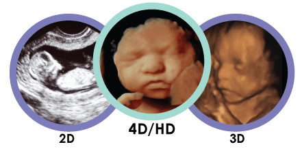 فرق بین سونوگرافی 3 بعدی و 4 بعدی فرق بین سونوگرافی 3 بعدی و 4 بعدی