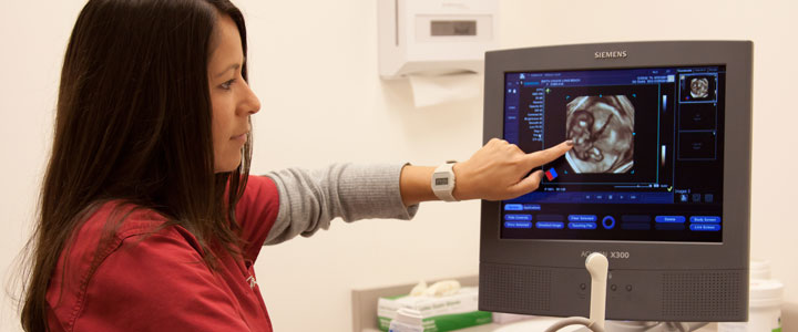 سونوگرافی در حاملگی سونوگرافی حاملگی