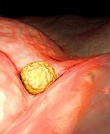 شکل جنین در هفته چهارم بارداری شکل جنین در هفته چهارم بارداری