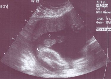 هفته بیست و هشتم بارداری هفته بیست و هشتم بارداری