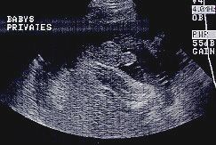 هفته بیست و نهم بارداری هفته بیست و نهم بارداری