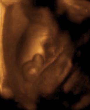 هفته بیست و هشتم بارداری سونوگرافی سه بعدی هفته بیست و هشتم بارداری سونوگرافی سه بعدی