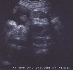 عکس جنین در سونوگرافی هفته سی و چهارم بارداری عکس جنین در سونوگرافی هفته سی و چهارم بارداری