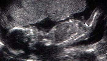 هفته بیست و یکم بارداری هفته بیست و یکم بارداری