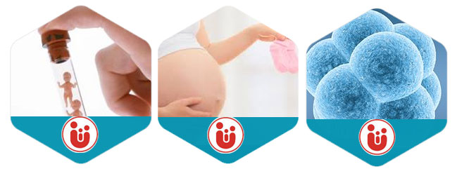 ivf چگونه انجام میشود ivf چگونه انجام میشود