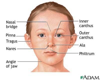 ویژگی های صورت در سندرم داون