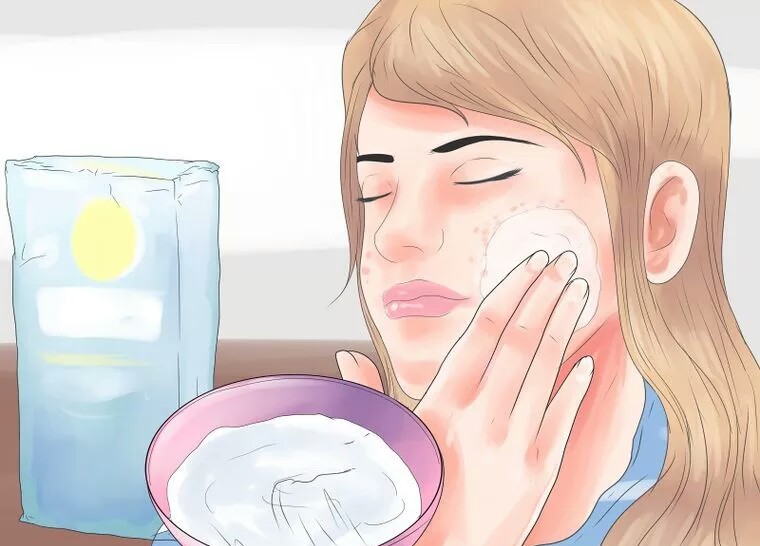 از بین بردن سریع جای جوش با جوش شیرین از بین بردن سریع جای جوش با جوش شیرین