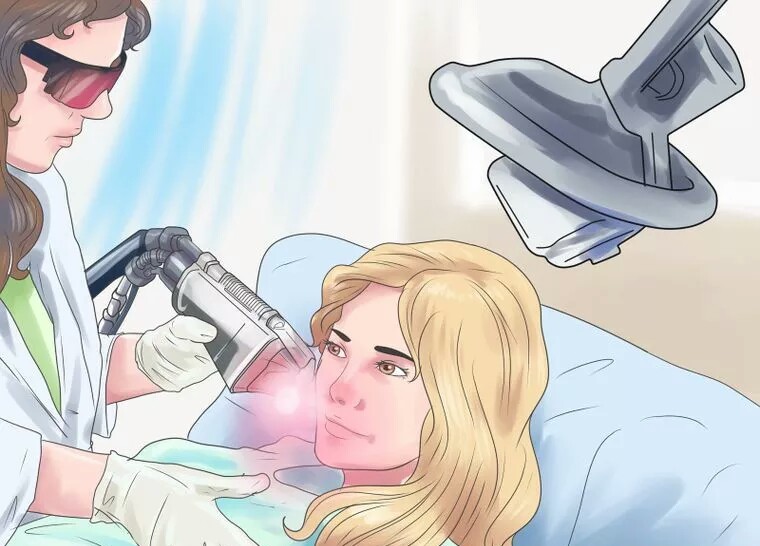 از بین بردن سریع جای جوش با لیزر از بین بردن سریع جای جوش با لیزر