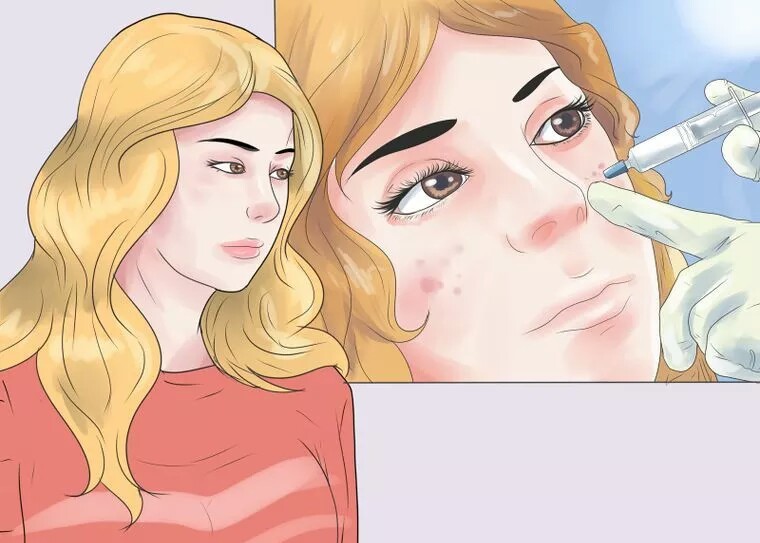 از بین بردن سریع جای جوش با پرکننده ها از بین بردن سریع جای جوش با پرکننده ها