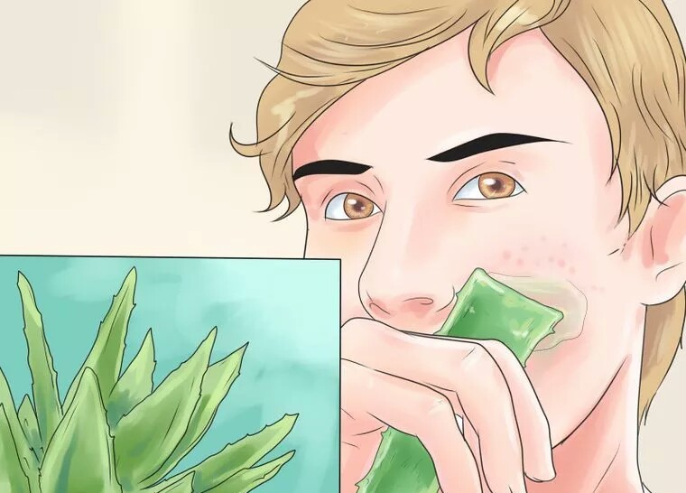 از بین بردن سریع جای جوش با آلوئه ورا از بین بردن سریع جای جوش با آلوئه ورا