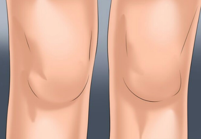 داشتن تحرک برای کاهش درد روماتیسم داشتن تحرک برای کاهش درد روماتیسم