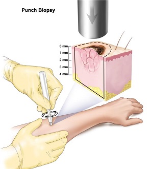 بافت برداری از پوست