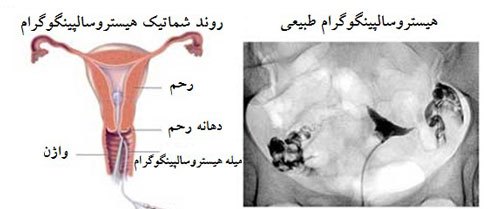 زمان عکس رنگی از رحم شرایط انجام سلامت بانوان اوما