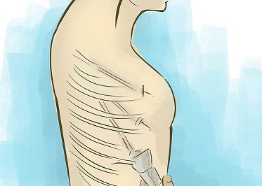 در مورد سمپاتکتومی توراسیس به عنوان آخرین راهکار برای درمان کاهش عرق زیر بغل فکر کنید در مورد سمپاتکتومی توراسیس به عنوان آخرین راهکار برای درمان کاهش عرق زیر بغل فکر کنید