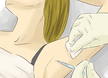 بوتاکس را به عنوان یک راه حل بلند مدت برای کاهش عرق زیر بغل در نظر بگیرید بوتاکس را به عنوان یک راه حل بلند مدت برای کاهش عرق زیر بغل در نظر بگیرید