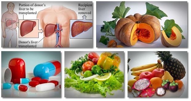 درمان کبد چرب