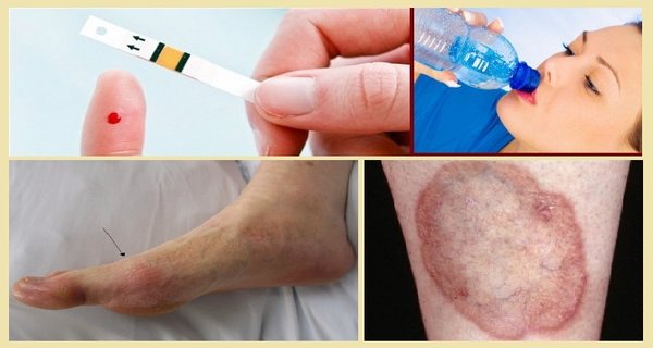 علائم و نشانه های دیابت