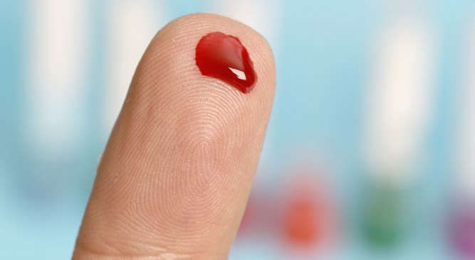 چگونگی تشخیص دیابت