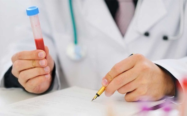 تفسیر نتیجه آزمایش پرولاکتین