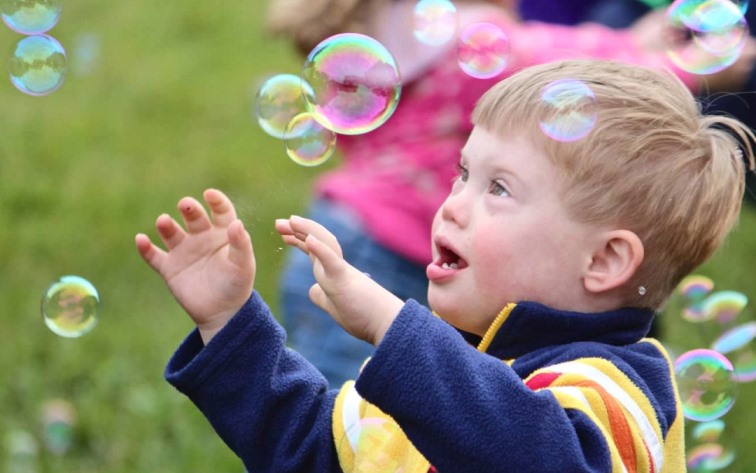 علائم سندرم دوان در بارداری