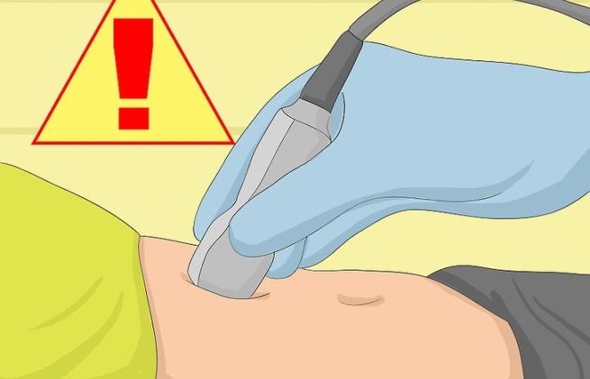 تشخیص حاملگی خارج رحمی تشخیص حاملگی خارج رحمی