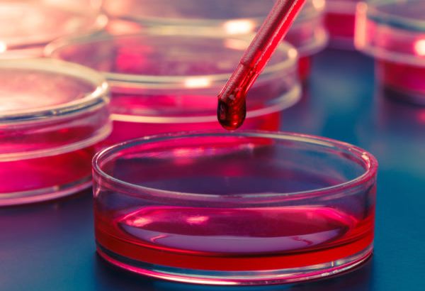 خونگیری آزمایش پرولاکتین