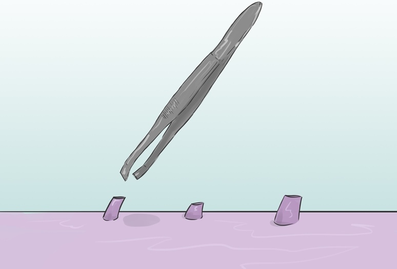 موچین و موهای زاید ناحیه تناسلی