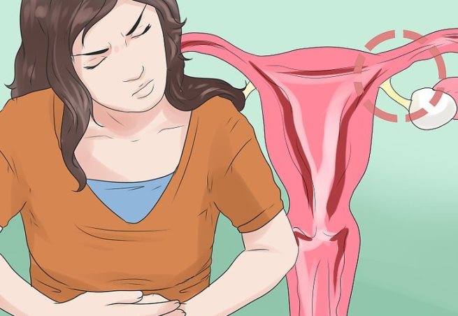 علائم بیماری آندومتریوز علائم بیماری آندومتریوز