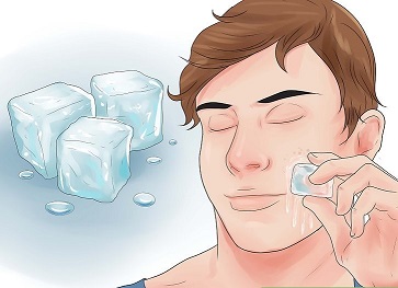 یخ و جوش صورت