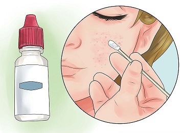 قطره چشم و جوش های صورت