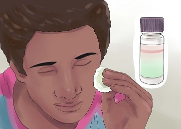 اسید سالیسیلیک و بهبود جوش های صورت