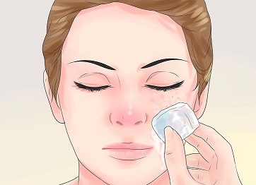 ادامه روند درمان جوش های صورت