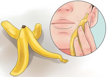 پوست موز و جوش صورت