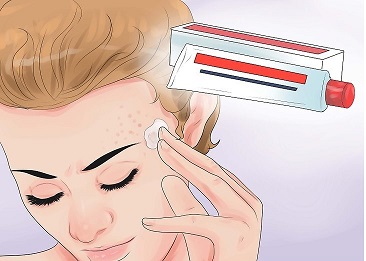 خمیردندان طبیعی و بهبود جوش های صورت