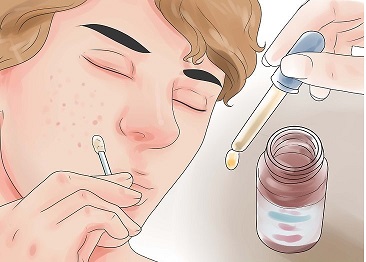 روغن چای و جوش های صورت