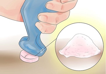 آسپرین و بهبود جوش صورت