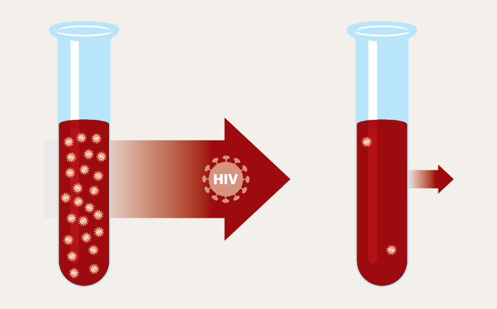 درمان ایدز چگونه است درمان ایدز چگونه است