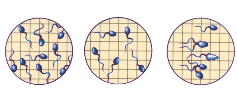 تفسیر آزمایش اسپرم