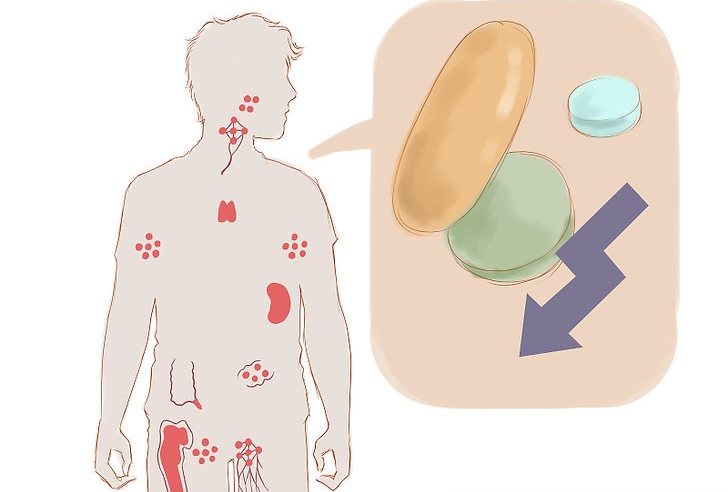 درمان بیماری لوپوس درمان بیماری لوپوس