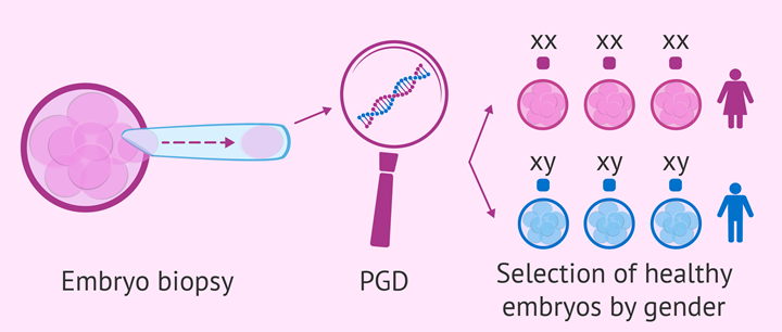 مزایای استفاده از روش PGD