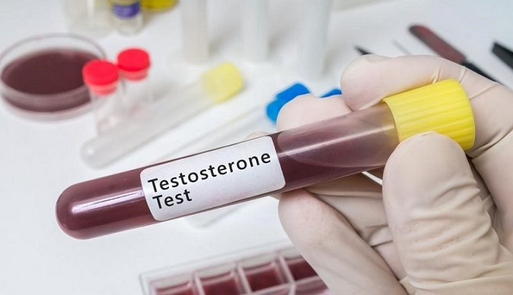 آزمایش خون برای بررسی تستوسترون آزمایش خون برای بررسی تستوسترون