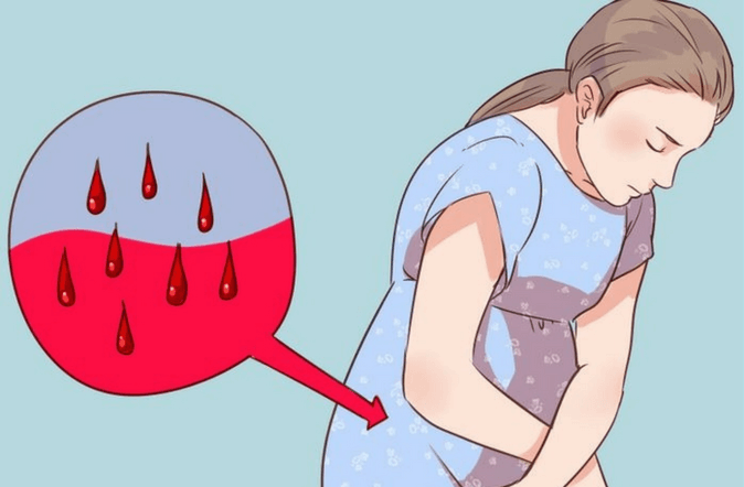 لکه بینی در بارداری لکه بینی در بارداری