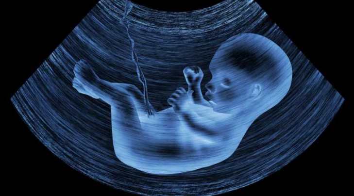 زمان انجام سونو داپلر زمان انجام سونو داپلر