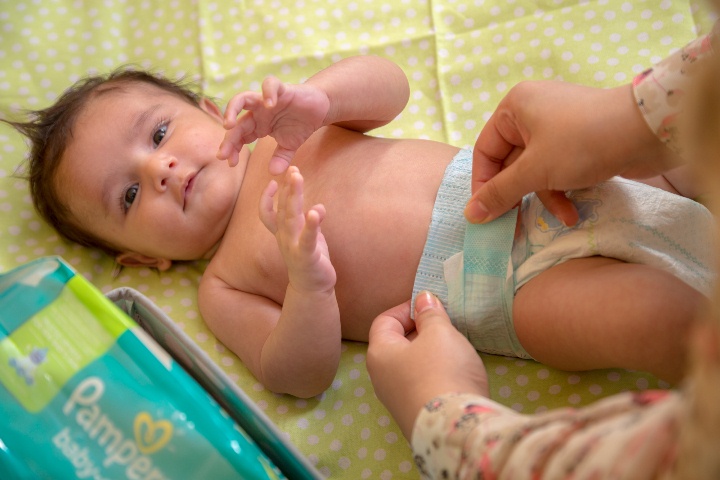 درماتیت پوشکی درماتیت پوشکی