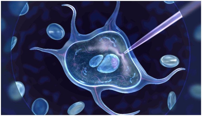 علت ایجاد سندرم تحریک بیش از حد تخمدان