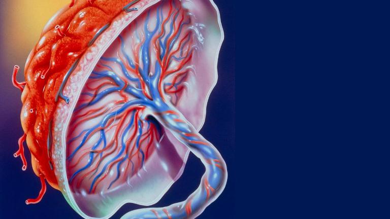 مشکلات مربوط به پلاسنتا یا جفت مشکلات مربوط به پلاسنتا یا جفت