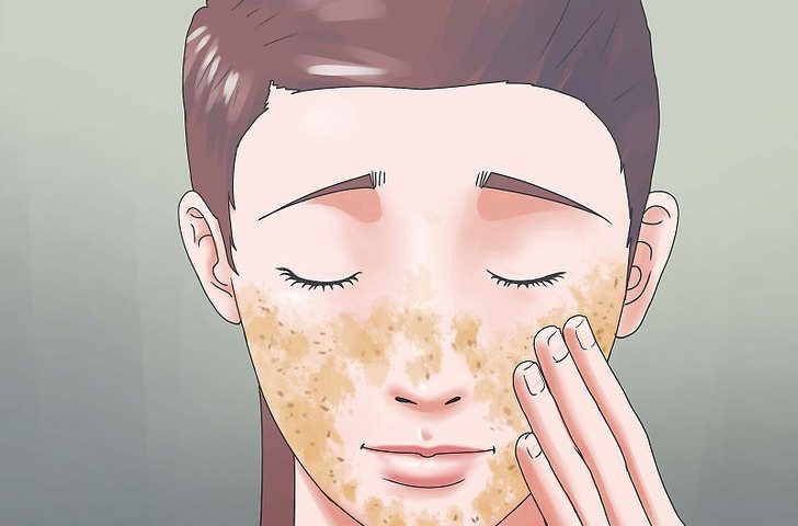 سیاه دانه و استفاده موضعی سیاه دانه و استفاده موضعی