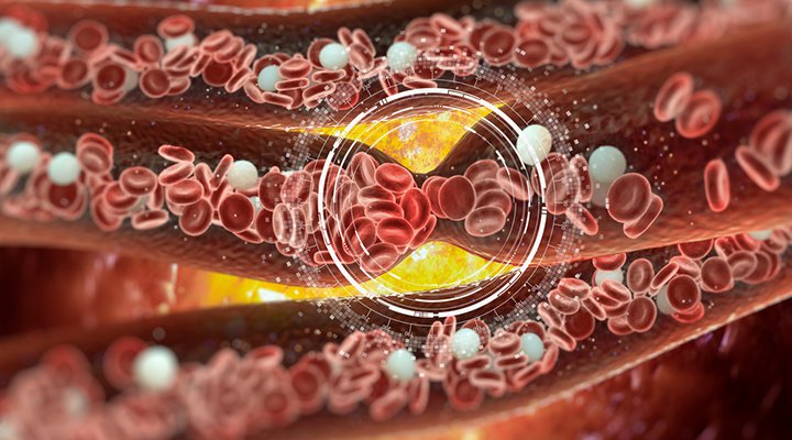 علت غلظت خون